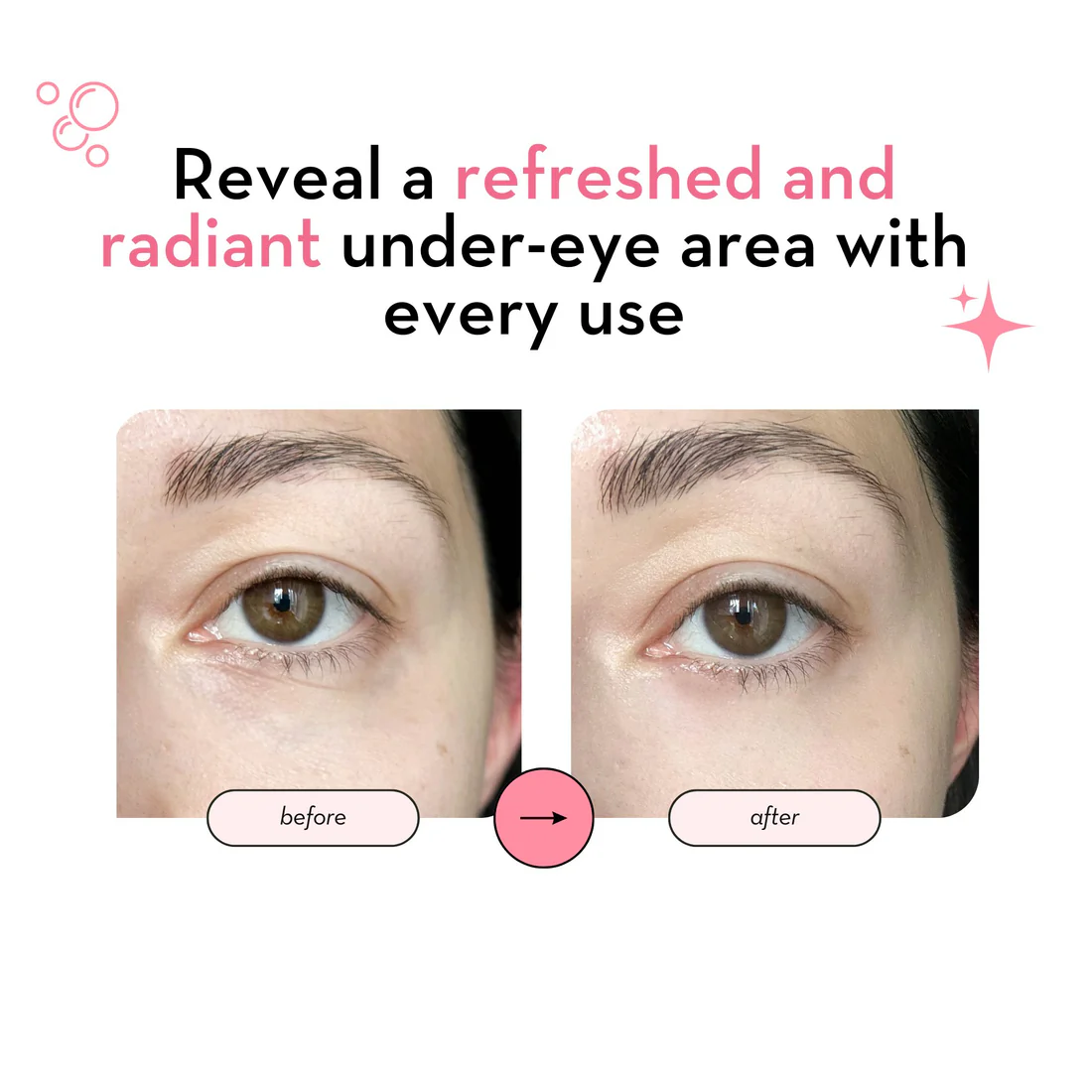 korean-skincare-and-beauty-under-eye-patches-with-24k-gold-hydrating-brightening-eye-mask-for-puffy-eyes-and-wrinkles-cruelty-free-867329_1100x